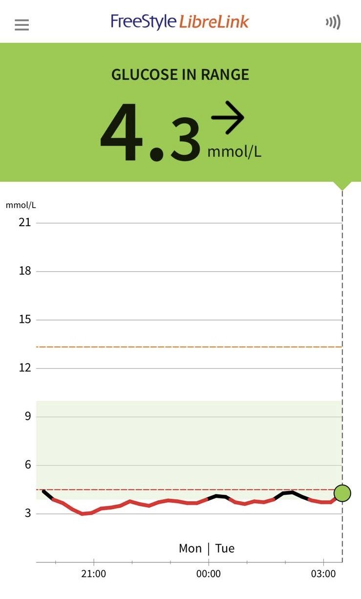 The founder's own FreeStyle LibreLink glucose graph — an overnight dip below 4 recovering to 4.3 mmol/L, back in range